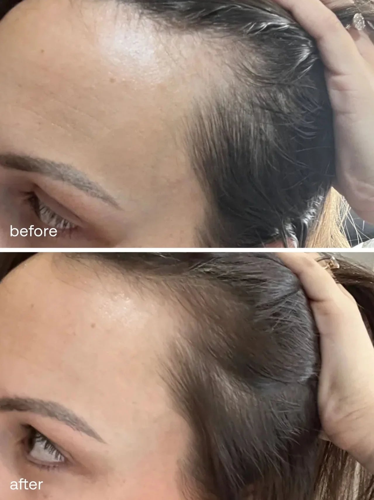 Ukhair Hair Growth Serum 50ml