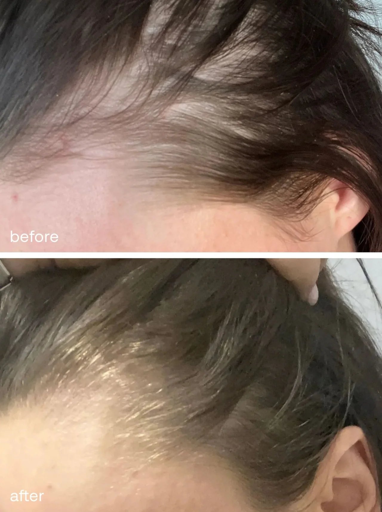 Ukhair Hair Growth Serum 50ml